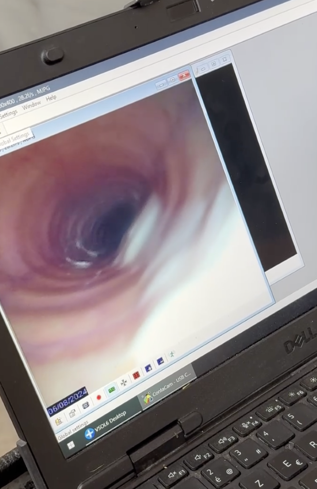 Endoscopisch onderzoek